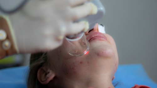 Kožní ambulance novoměstské nemocnice zažívá extrémní nápor pacientů. Musí omezit příjem nových