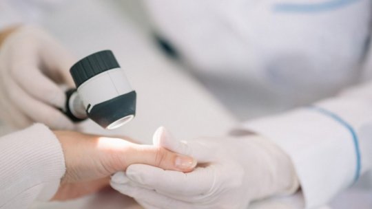 Dům zdraví zveřejnil informace pro pacienty dermatovenerologické ambulance