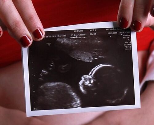 pregnancy-3590794 1280